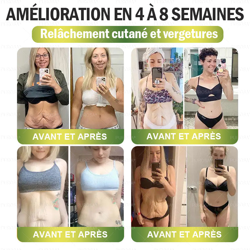 CANADA Cliniquement prouvé | Boutique officielle | Patch nano à microneedles CrazyLeaf® SMGT-GLP-1 avec collagène et Matrixyl 3000 | Cible : obésité, peau relâchée, hypertension, diabète, foie gras, douleurs articulaires, brouillard cérébral, fatigue