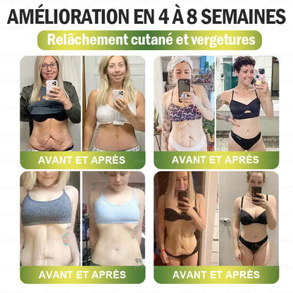 CANADA Cliniquement prouvé | Boutique officielle | Patch nano à microneedles CrazyLeaf® SMGT-GLP-1 avec collagène et Matrixyl 3000 | Cible : obésité, peau relâchée, hypertension, diabète, foie gras, douleurs articulaires, brouillard cérébral, fatigue